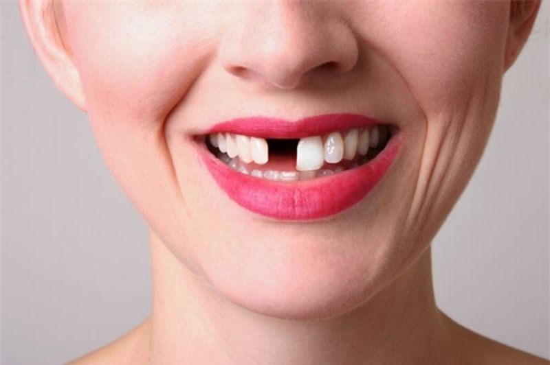 Chọn số để đổi đời với giấc mơ rụng răng