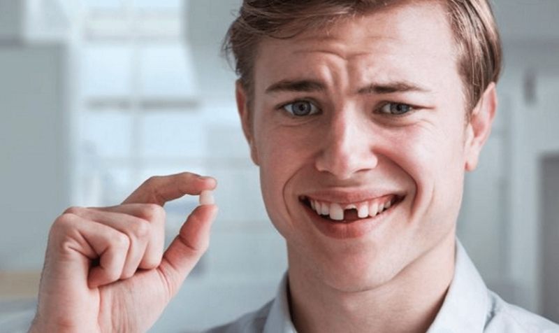 Rất nhiều người nằm mơ thấy rụng răng